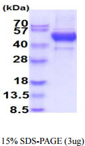 3 μg by SDS-PAGE under reducing condition and visualized by coomassie blue stain.